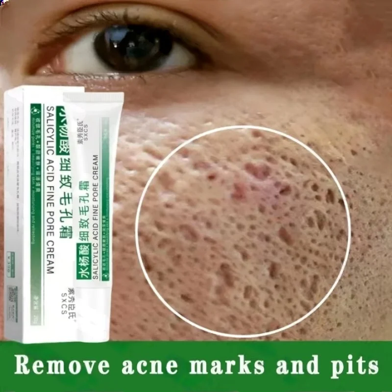 Korean Skincare Routine - サリチル酸毛穴クリアリングクリーム毛穴を縮小黒ずみ除去にきび明るく保湿スムーズなスキンケア韓国製品