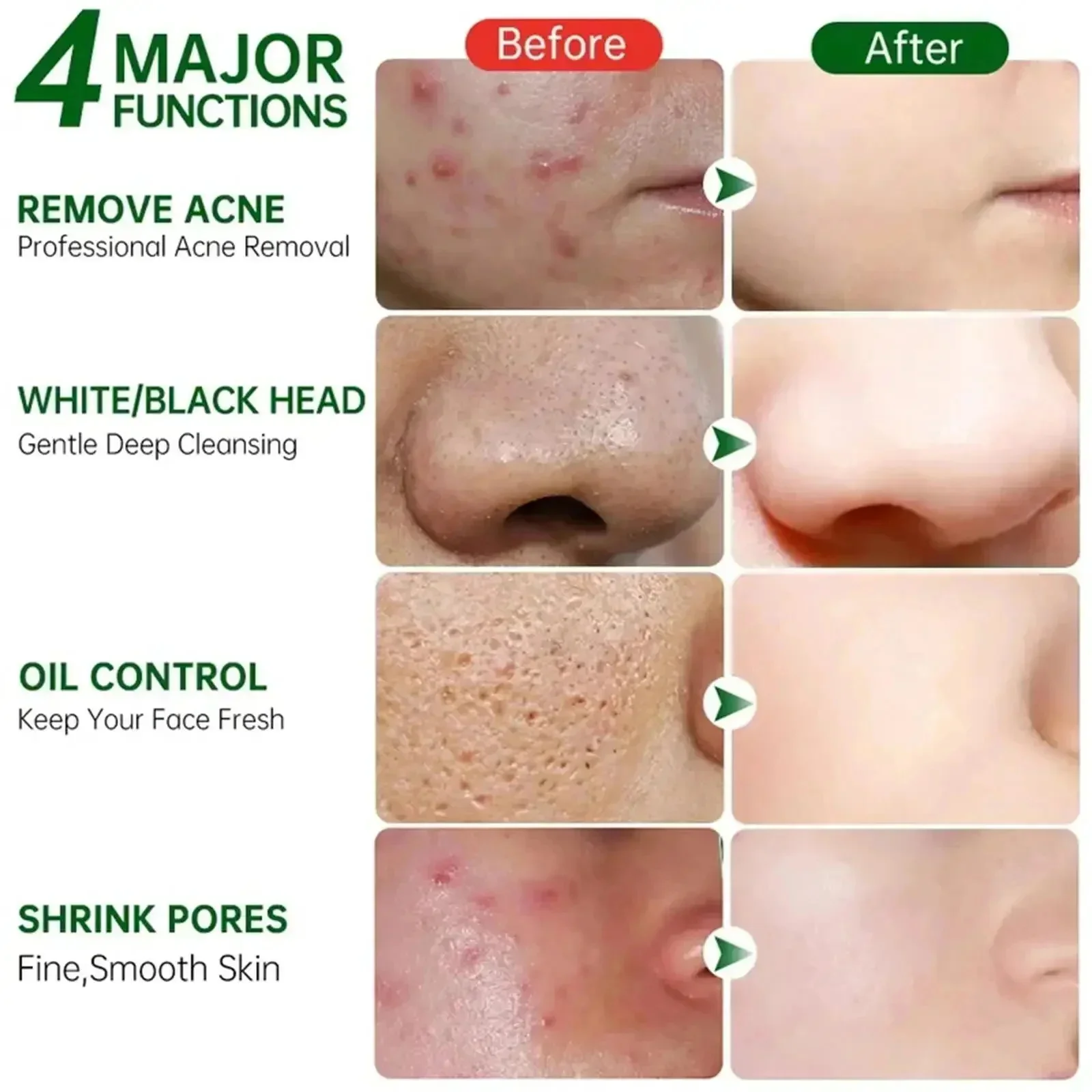 サリチル酸毛穴クリアリングクリーム毛穴を縮小黒ずみ除去にきび - Korean Skincare Routine のレビューと価格